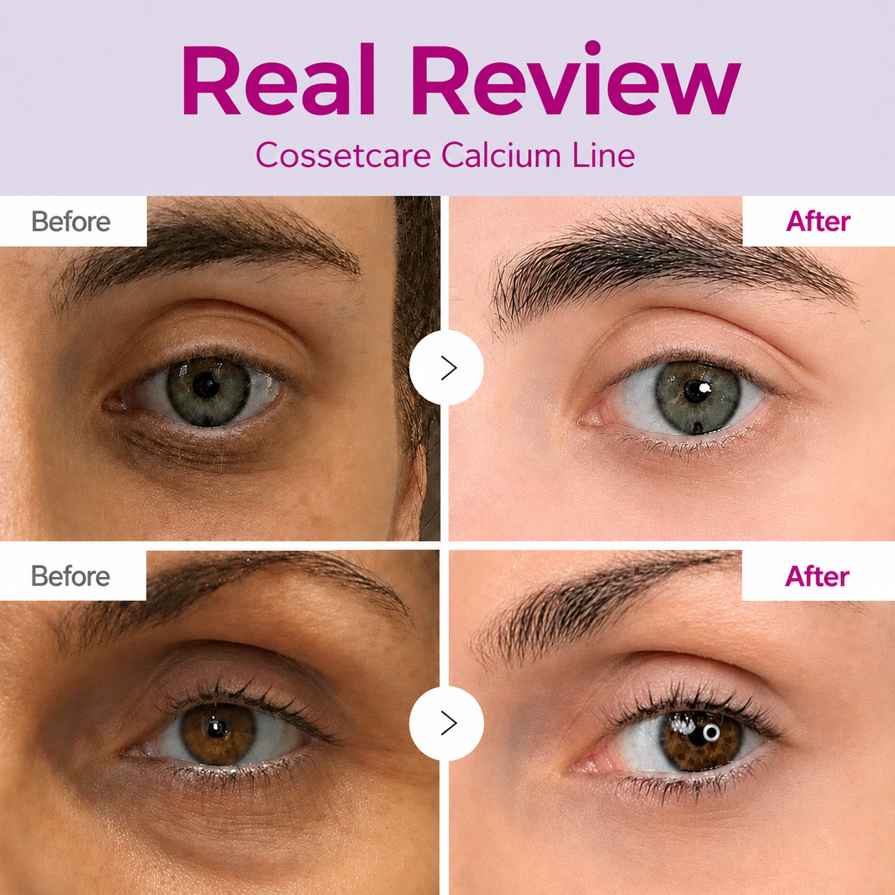 FREEAMIABLE Korean Calcium Dark Spot Eye Cream