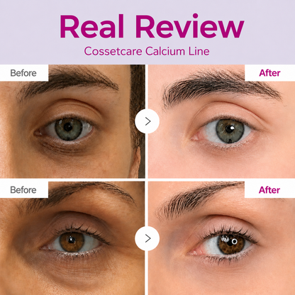 FREEAMIABLE Korean Calcium Dark Spot Eye Cream