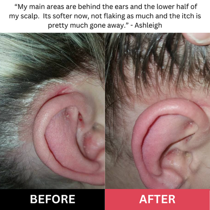 revive + restore scalp scrub