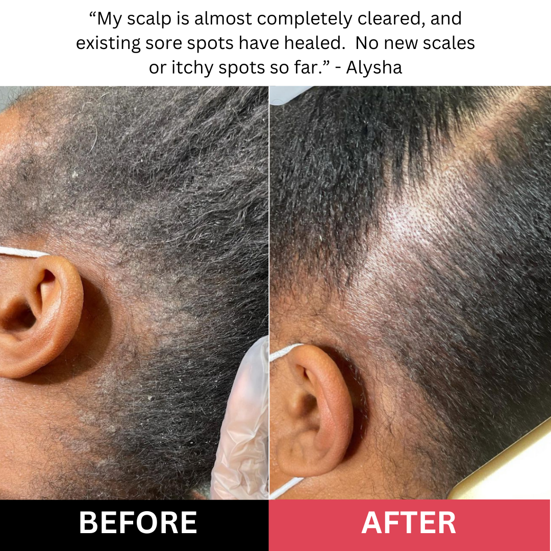revive + restore scalp scrub